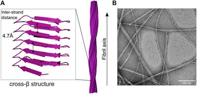 The role of heat shock proteins in preventing amyloid toxicity